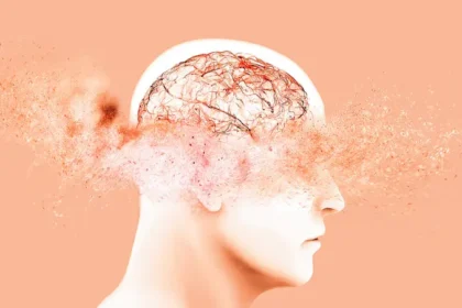 الإصابة بالخرف