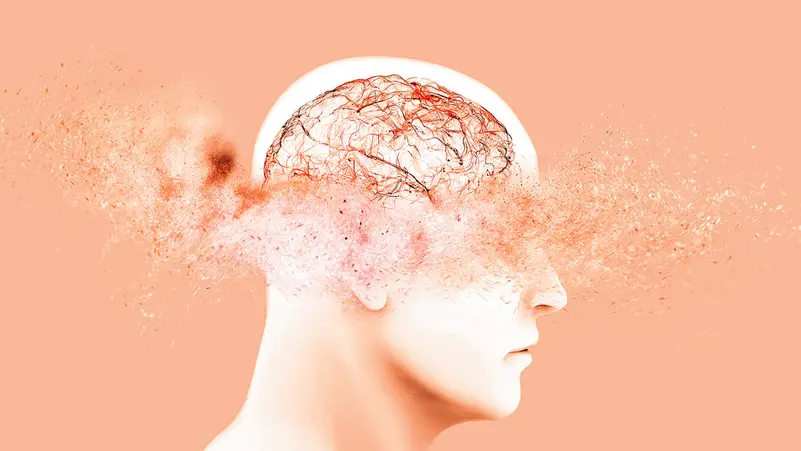 الإصابة بالخرف